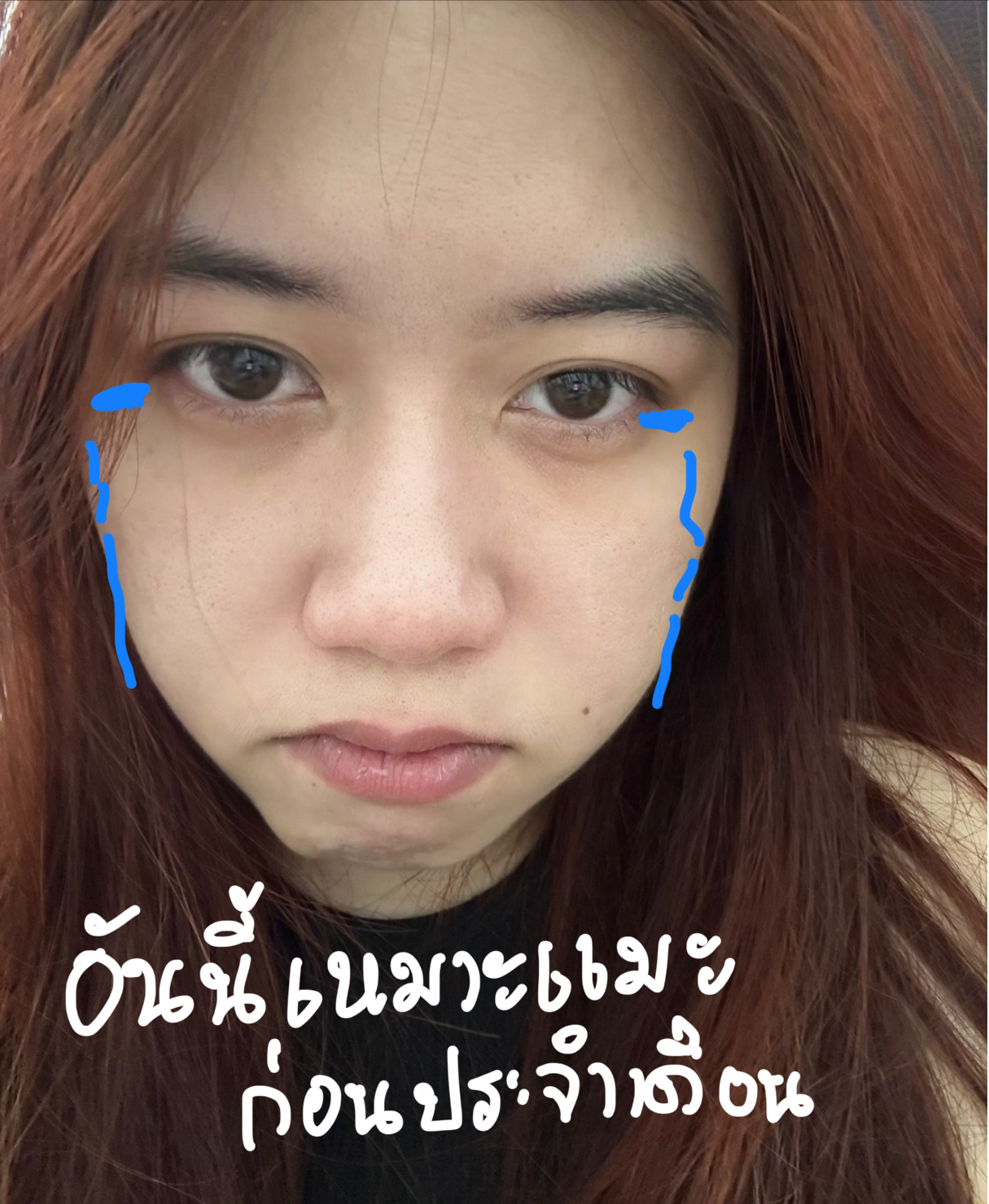 ภาพที่ 14